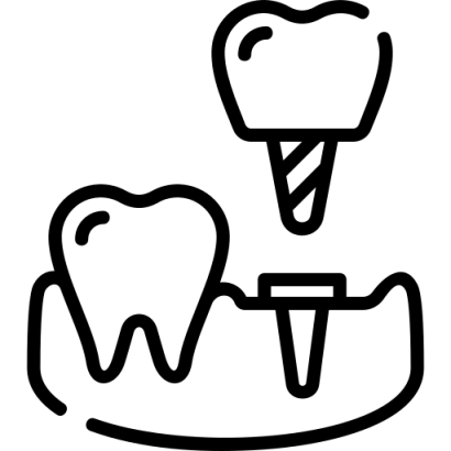 implant _1_.png
