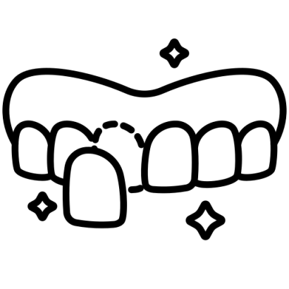 dental-veneer.png